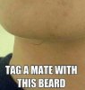 tag-matte-with-the-beard.jpg