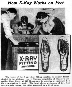 How-X-ray-works-on-feet-1940-856x1024.jpg